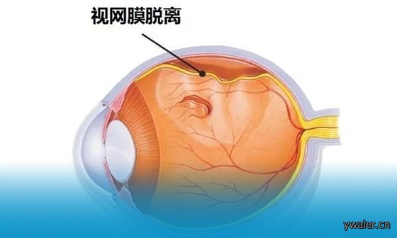 图片名称